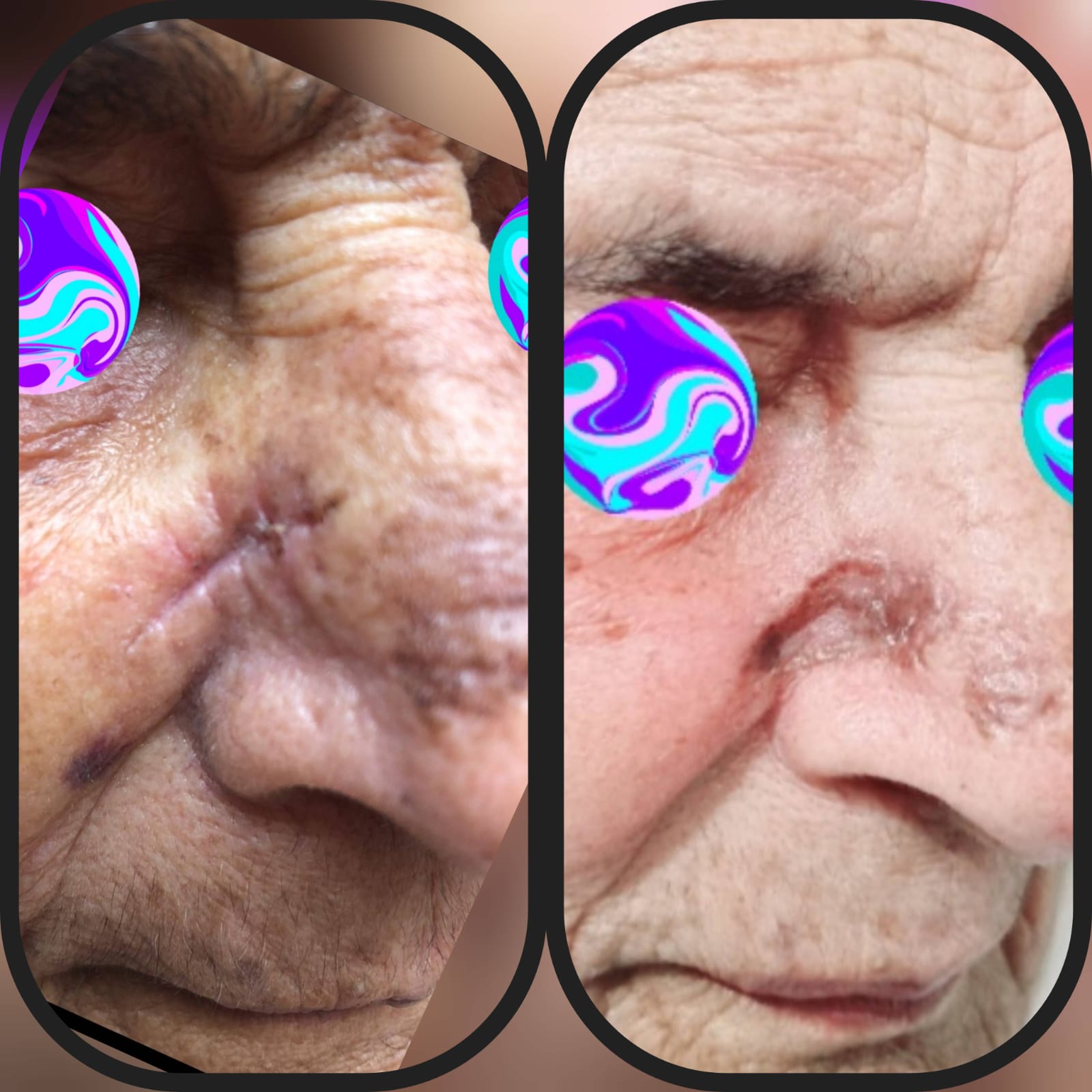Before & After 36